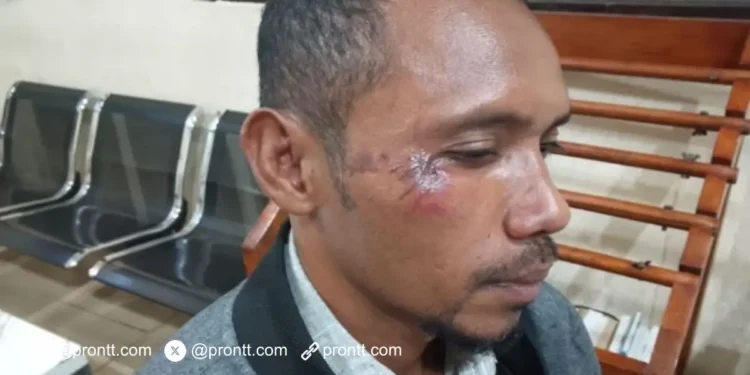 Kades Letmafo Keroyok Wartawan ViralNTT Hingga Babak Belur